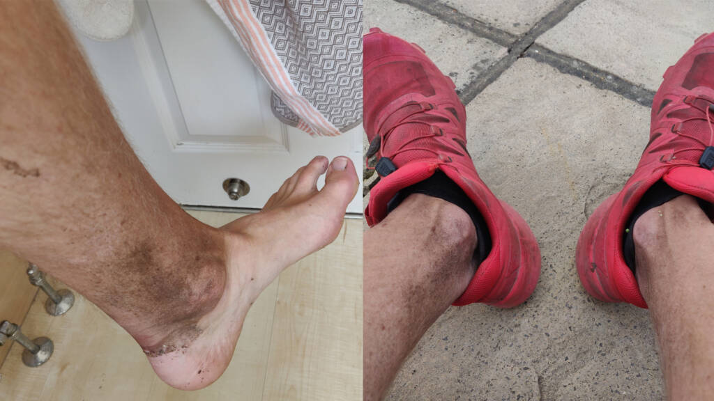 dirt and mud making up a clearly visible line on ankles after a long trail run