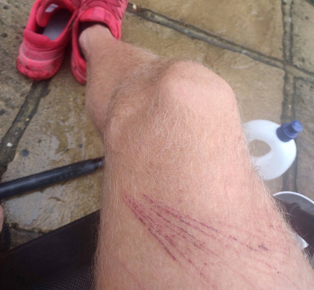 bramble cuts and scrapes on a leg